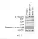 Fig. 08 - Cancer stem cell isolation