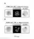 Fig. 46 - Cancer stem cell isolation