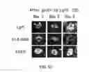Fig. 52 - Cancer stem cell isolation