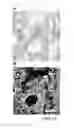 Fig. 53 - Cancer stem cell isolation