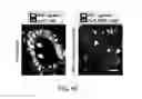 Fig. 67 - Cancer stem cell isolation