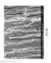 Fig. 09 - Desensitizing toothpaste