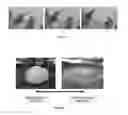Fig. 02 - Advanced functional biocompatible polymer putty used as a hemostatic agent for treating damaged tissue and cells