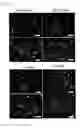 Fig. 20 - ENDOTHELIAL CELL CULTURE
