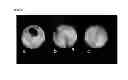 Fig. 04 - CELL PREPARATION FOR ERECTILE DYSFUNCTION OR SENSORY DISORDERS OF THE LOWER URINARY TRACT CONTAINING ADIPOSE TISSUE DERIVED MESENCHYMAL STEM CELLS