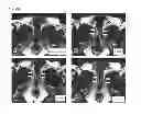 Fig. 11 - CELL PREPARATION FOR ERECTILE DYSFUNCTION OR SENSORY DISORDERS OF THE LOWER URINARY TRACT CONTAINING ADIPOSE TISSUE DERIVED MESENCHYMAL STEM CELLS