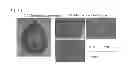Fig. 22 - CELL PREPARATION FOR ERECTILE DYSFUNCTION OR SENSORY DISORDERS OF THE LOWER URINARY TRACT CONTAINING ADIPOSE TISSUE DERIVED MESENCHYMAL STEM CELLS
