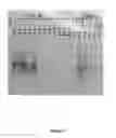 Fig. 06 - Synthesis of long-chain polyunsaturated fatty acids by recombinant cell