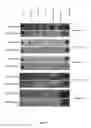 Fig. 11 - Synthesis of long-chain polyunsaturated fatty acids by recombinant cell