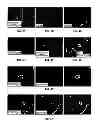 Fig. 07 - MCAM ANTAGONISTS AND METHODS OF TREATMENT