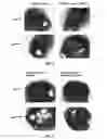 Fig. 04 - PREDICTING RESPONSE TO EGFR INHIBITORS