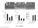 Fig. 03 - Signatures and determinants associated with prostate cancer progression and methods of use thereof