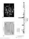 Fig. 16 - Signatures and determinants associated with prostate cancer progression and methods of use thereof