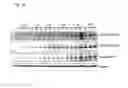 Fig. 28 - MODULATION OF HISTONE DEACETYLASES FOR THE TREATMENT OF METABOLIC DISEASE, METHODS AND COMPOSITIONS RELATED THERETO