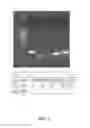 Fig. 02 - METHOD TO MEASURE INFLAMMATION IN THE CONJUNCTIVA OF PATIENTS WITH TEAR DYSFUNCTION