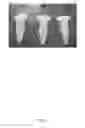 Fig. 05 - Functionalized nanodiamonds as delivery platforms for nucleic acids