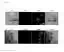 Fig. 07 - Agent for evading immune response