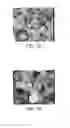 Fig. 04 - VITAMIN K2 MICROSPHERES