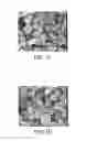 Fig. 05 - VITAMIN K2 MICROSPHERES