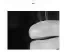 Fig. 02 - PROCESS AND COMPOSITION OF A GEL FOR WOUND DISINFECTION AND PROMOTION OF HEALING
