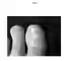 Fig. 03 - PROCESS AND COMPOSITION OF A GEL FOR WOUND DISINFECTION AND PROMOTION OF HEALING