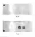 Fig. 05 - Intra-mammary teat sealant formulation and method of using same to reduce or eliminate visual defects in aged cheeses