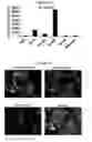 Fig. 44 - Compositions and methods for drug-sensitization or inhibition of a cancer cell