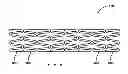 Fig. 01 - GRADIENT COATED STENT AND METHOD OF FABRICATION