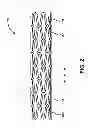 Fig. 03 - GRADIENT COATED STENT AND METHOD OF FABRICATION