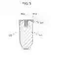 Fig. 06 - Implant structure