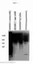 Fig. 04 - ALPHA TOXIN DETECTION OF GPI ANCHORED PROTEINS