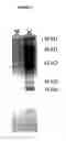 Fig. 06 - ALPHA TOXIN DETECTION OF GPI ANCHORED PROTEINS