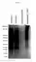 Fig. 08 - ALPHA TOXIN DETECTION OF GPI ANCHORED PROTEINS