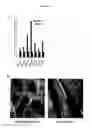 Fig. 11 - ALPHA TOXIN DETECTION OF GPI ANCHORED PROTEINS