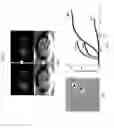 Fig. 02 - Capturing of cell fluid and analysis of its components under observation of cells and instruments for the cell fluid capturing and the analysis