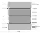 Fig. 06 - Methods for thick films thermoelectric device fabrication