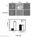 Fig. 12 - METHODS AND MATERIALS FOR MODULATING DEUBIQUITINASES AND UBIQUITINATED POLYPEPTIDES
