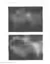 Fig. 06 - Agent for the treatment of alopecia