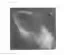 Fig. 07 - Agent for the treatment of alopecia