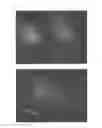 Fig. 08 - Agent for the treatment of alopecia