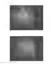 Fig. 32 - Agent for the treatment of alopecia