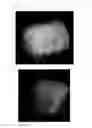 Fig. 41 - Agent for the treatment of alopecia