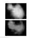 Fig. 44 - Agent for the treatment of alopecia