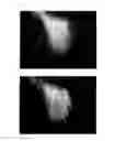 Fig. 45 - Agent for the treatment of alopecia