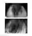 Fig. 46 - Agent for the treatment of alopecia