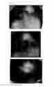 Fig. 47 - Agent for the treatment of alopecia