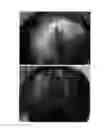 Fig. 48 - Agent for the treatment of alopecia