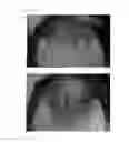 Fig. 49 - Agent for the treatment of alopecia