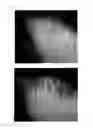 Fig. 52 - Agent for the treatment of alopecia