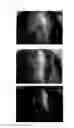 Fig. 53 - Agent for the treatment of alopecia